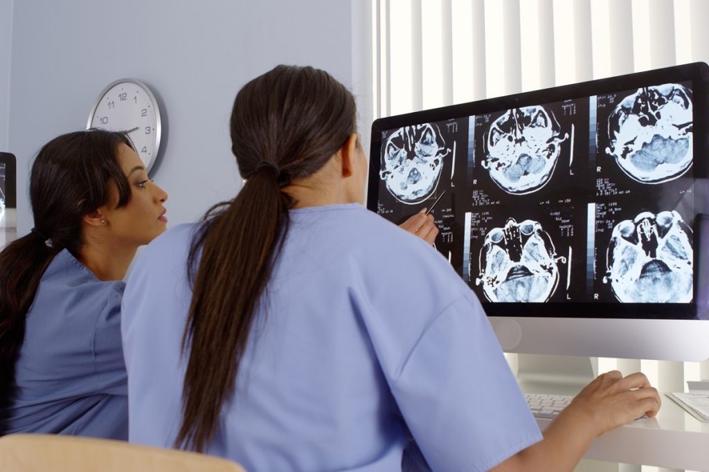 Study Finds AI Accuracy in Radiology Varies Significantly Across Radiologists